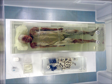 Jingzhou Mummy